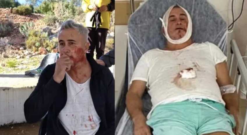 U14 maçı sonrası şiddet iddiası: Veli hastanede